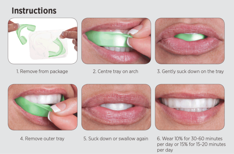 Teeth Whitening Service Process - West Jordan, UT